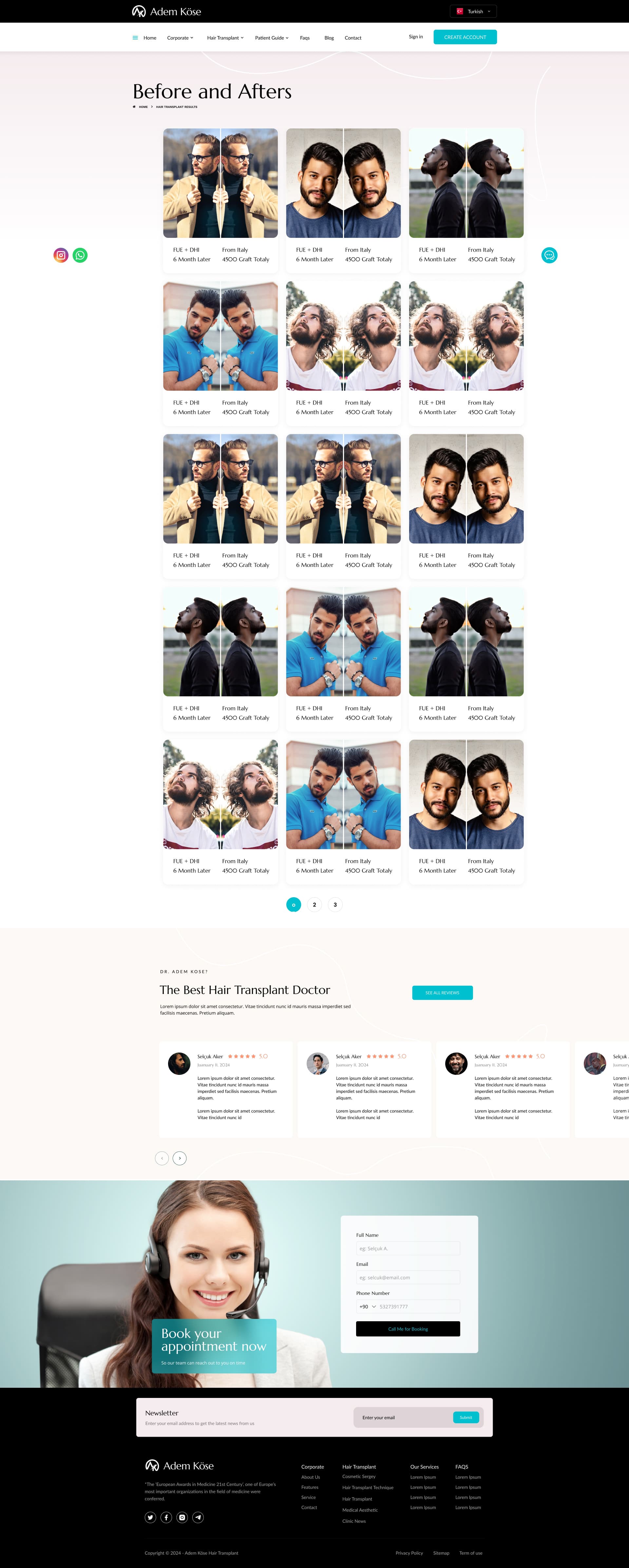 Adem Köse Hair Transplant — project detail 11, Selçuk Aker