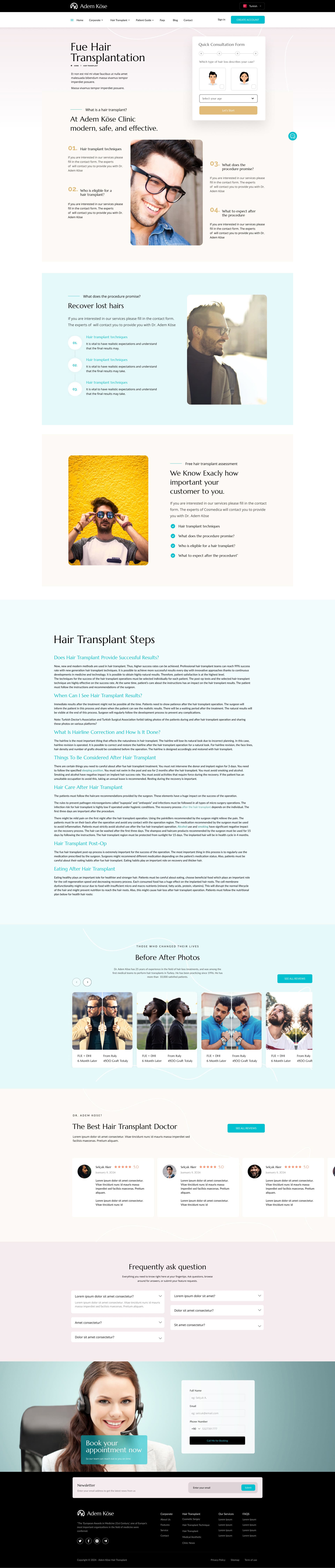 Adem Köse Hair Transplant — project detail 15, Selçuk Aker
